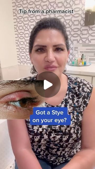 Stye Remedies Fast How To Get Rid At Home, Sty Eye Remedies How To Get Rid, Eye Stye Remedies How To Get Rid, How To Treat A Stye Eye, Stye Remedies Fast How To Get Rid, Sty In Eye Remedies, Eye Sty, Stye Remedies Fast, Stye Remedy