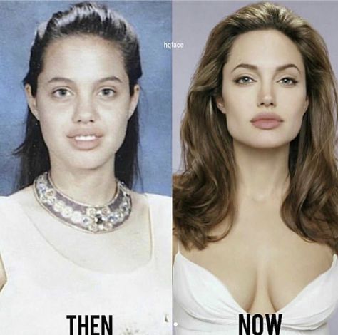 Angelina Jolie Nose, Angelina Jolie Plastic Surgery, Plastic Surgery Fail, Plastic Surgery Photos, Celebrity Plastic Surgery, Celebrities Then And Now, Celebrities Before And After, Nose Job, Body Makeup