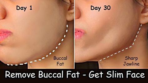 Remove double chin & buccal fat at homeLose Double Chin & Face Fat in 10 Days - Lose Neck Fat | Slim Face Exercise | Double Chin ExerciseLose Face Fat in 10 ... Exercise Double Chin, Slim Face Exercise, How To Get Jawline, Cheekbones Exercise, Remove Double Chin, Sharp Jawline, Cheek Fat, Jawline Exercise, Slim Face