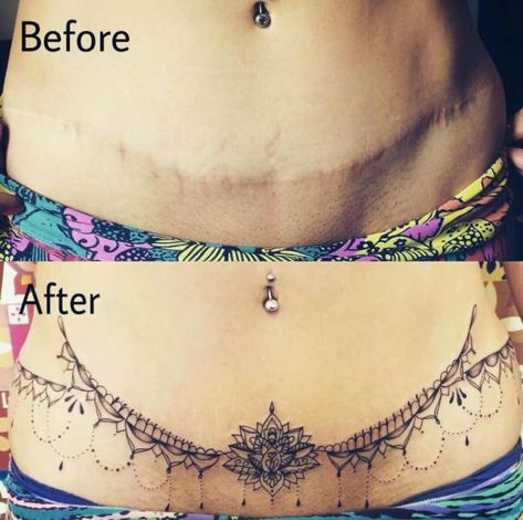 Tummy Tuck Tattoo: What You Need to Know | Art and Design Lower Stomach Tattoos For Women, Lower Belly Tattoos, Abdomen Tattoo, Tummy Tattoo, Button Tattoo, Henne Tattoo, Stomach Tattoos Women, Tattoos To Cover Scars, Bauch Tattoos