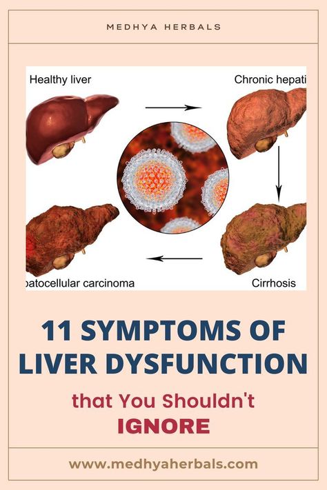 not-given #LiverHealthMatters #HealthyLiverHappyLife #LiverWellness #SupportLiverHealth #LiverDetoxTips #LiverDietIdeas #CleanLiverCleanLife #LiverCareJourney #NourishYourLiver #LiverLovingFoods Liver Cleanse Diet, Liver Detox Diet, Liver Damage, Liver Issues, Liver Failure, Unhealthy Diet, Liver Detoxification, Liver Detox, Healthy Liver