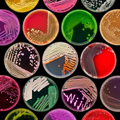 Finalist | Plants & Fungi Microbiology Photography, Microorganisms Microbiology, Microbiology Aesthetic, Microbiology Art, Microbiology Lab, مشروعات العلوم, Petri Dishes, Science Stickers, Biology Art