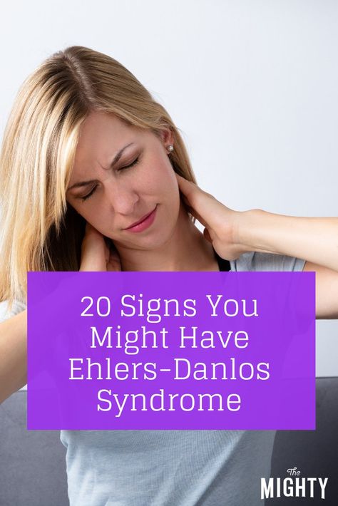 20 Signs You Might Have Ehlers-Danlos Syndrome Ehler Danlos Syndrome, Hyper Mobility Syndrome, Ehlers Danlos Syndrome Diet, Elhers Danlos Syndrome Hypermobility, Eds Symptoms, Hypermobile Ehlers Danlos Syndrome, Eds Ehlers Danlos Syndrome, Ehlers Danlos Syndrome Types, Ehlers Danlos Syndrome Symptoms