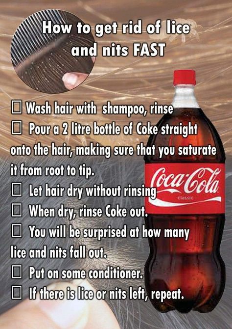 Despite claims that Coca-Cola is an effective solution for eliminating head lice, the evidence that it actually works isn't compelling. Lice Remedies, 1000 Lifehacks, Organizing Hacks, Homemade Remedies, Simple Life Hacks, Diy Life Hacks, Washing Hair, Useful Life Hacks, Health Remedies