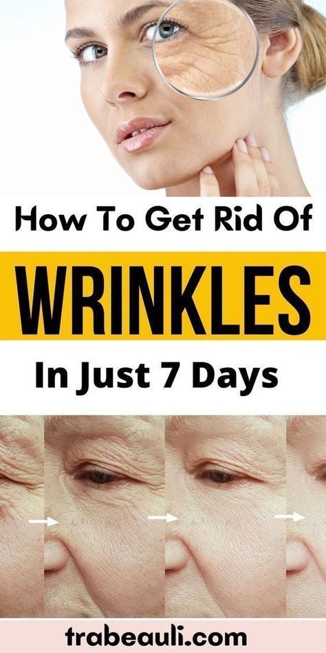 How To Get Rid Of Wrinkles In Just One Week Wrinkles Remedies Face, Home Remedies For Wrinkles, Lotion For Oily Skin, Get Rid Of Wrinkles, Wrinkle Remedies, Facial Wrinkles, Skin Care Face Mask, Skin Care Wrinkles, Moisturizer For Oily Skin