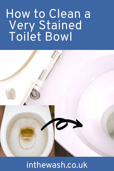 Nobody likes a dirty-looking loo, so here are some top tips and trick on how to clean a very stained toilet bowl. You'll have a sparkling bathroom throne to be proud of in no time at all. Cleaning Toilet Stains, Toilet Bowl Stain, Clean Toilet Bowl Stains, Toilet Bowl Stains, Pee Stains, Toilet Cleaning Hacks, Toilet Stains, Clean Toilet, Clean Toilet Bowl