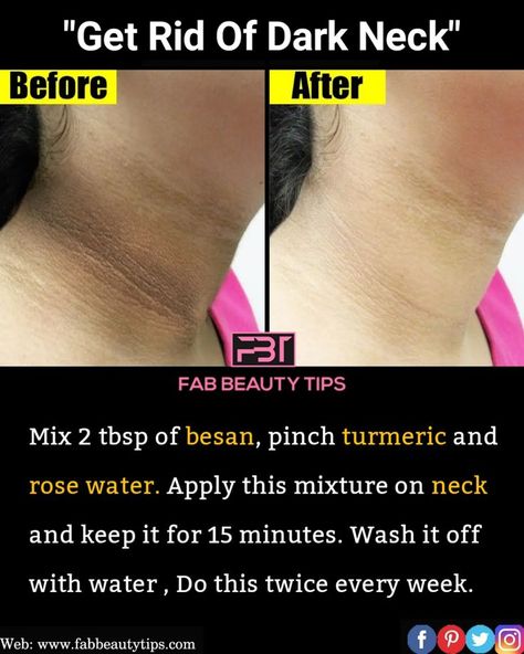 Dark Neck Remedies Fast, Dark Neck Remedies, Dark Neck, Clear Skin Fast, Beginner Skin Care Routine, Yoga Facts, Face Skin Care Routine, Natural Skin Care Remedies, Diy Skin Care Routine