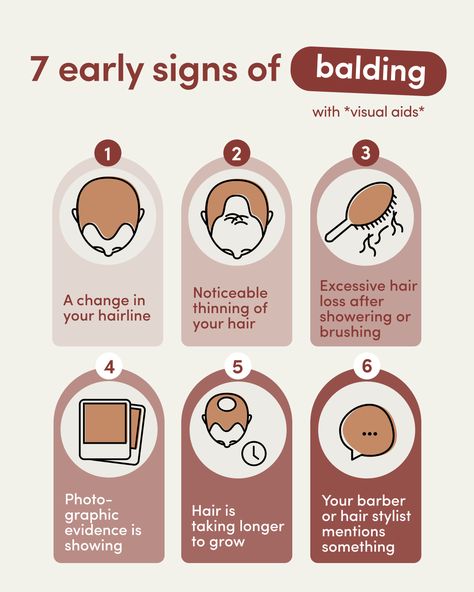 Male pattern baldness occurs in stages. So, even though it’s sneaky, if you learn how to recognize the signs early and are quick to start treating it, you may be able to not only keep the hair you have, but even get some of what you’ve lost back. Thinning Hair Men, Top Haircuts For Men, Hair Thickening Shampoo, Androgenetic Alopecia, Male Pattern Baldness, Thickening Shampoo, Pattern Baldness, Itchy Scalp, Hair Thickening