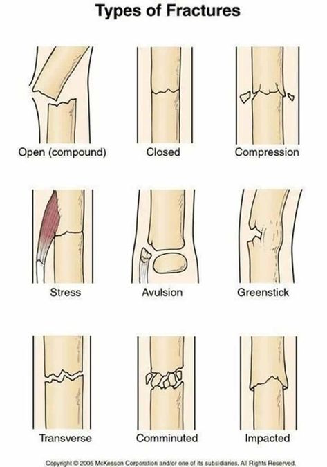 Human Anatomy Chart, Nursing Things, Vet Nurse, Surgical Technologist, Vet Medicine, Medical Student Study, Nursing School Survival, Nursing School Studying, Medical Facts