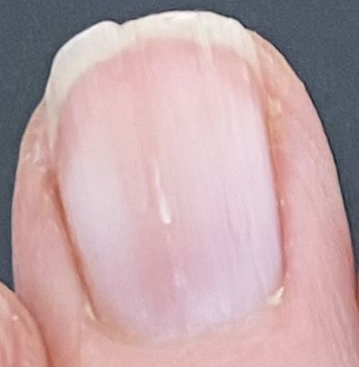 Split Fingernails Remedies, How To Stop Nails From Splitting, Nail Splitting Remedies, Nail Splitting Down The Middle, Split Nails Remedies, How To Fix A Split Fingernail, Finger Nails Health, Nail Ridges Vertical Warning Signs, Splitting Nails Remedies