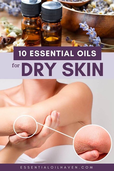 How to Treat Dry Skin with Essential Oils. Includes the Top 10 Essential Oils for Dry Skin. #dryskin #skincare #essentialoils Essential Oils For Dry Skin, Oils For Dry Skin, Dry Skin On Face, Oil For Dry Skin, Skin Care Lotions, Essential Oils For Skin, Cream For Dry Skin, Essential Oil Diffuser Blends, Oil Diffuser Blends