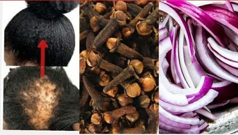 Best DIY natural easy to make hair grower. Clove Water, For Fast Hair Growth, Diy Haircare, Hair Grower, Fast Hair Growth, Home Hair, Fast Hair, Make Hair, Hair Growth Faster