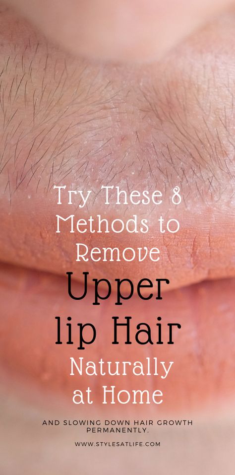 How To Remove Upper Lip Hair? : This article guides you on the different methods to get rid of hair on upper lip. Use them regularly to reduce the hair growth and the need for parlor treatments! Removing Upper Lip Hair, Get Rid Of Upper Lip Hair, How To Reduce Facial Hair Naturally, Uper Lips Hair Remover At Home, Mustache Removal For Women, Uper Lips Hair Remover, Upper Lip Hair Removal Permanent, Waxing Mustache Women Upper Lip, How To Get Rid Of Upper Lip Hair