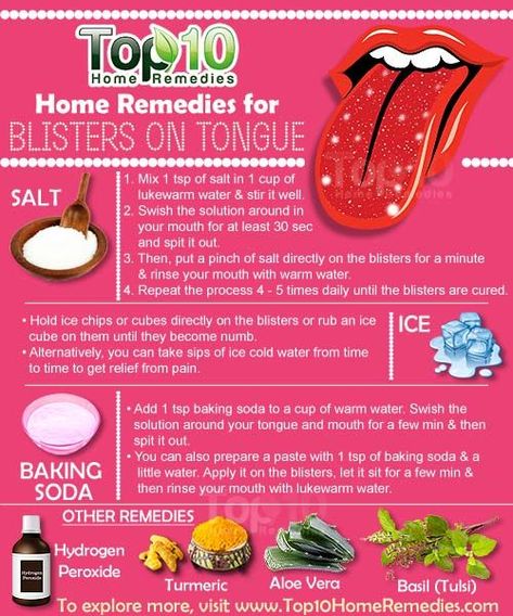 Home Remedies for Blisters on Tongue. You can try some natural #homeremedies to help alleviate the pain and inflammation caused b tongue blisters. Here are #top10homeremedies to promote faster healing. Blister On Tongue, How To Heal Blisters, Tongue Sores, Ice Chips, Top 10 Home Remedies, Canker Sore, Tongue Health, Holistic Remedies, The Tongue