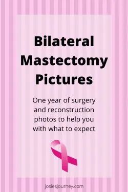 Radiation After Mastectomy, Brca2 Tattoo, Double Mastectomy Without Reconstruction, Bilateral Mastectomy Tattoo, Preventative Double Mastectomy, Mastectomy Cookies, Post Mastectomy Exercises, Prophylactic Bilateral Mastectomy, Mastectomy Recovery Must Haves