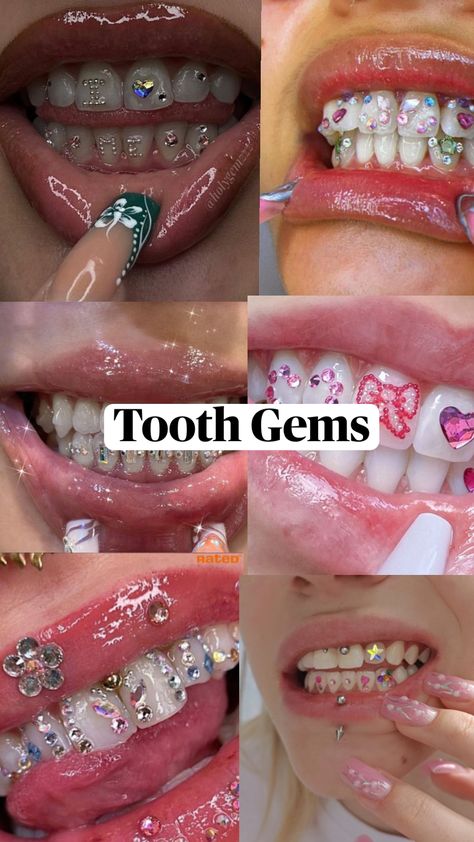 #toothgems #jewlery #pintrest #tooth #jems #cute #bling #charms #toothgemkit #Gold#silver #design Pretty Teeth, Dental Jewelry, Grillz Teeth, Getting Braces, Charm Bracelets For Girls, Gem Tattoo, Cute Braces, Diamond Teeth, Tooth Charm