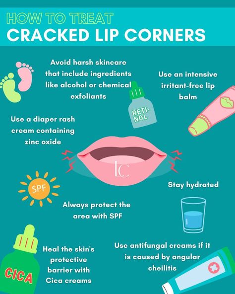 How to get rid of dry cracked lip corners fast Cracked Lip Corners, Dry Lips Remedy Overnight How To Get Rid, Cracked Lips Remedy, How To Get Rid Of Dry Lips, Antifungal Cream, Upper Lip Hair, Beauty Treatments Skin Care, Spf Lip Balm, Healing Ointment