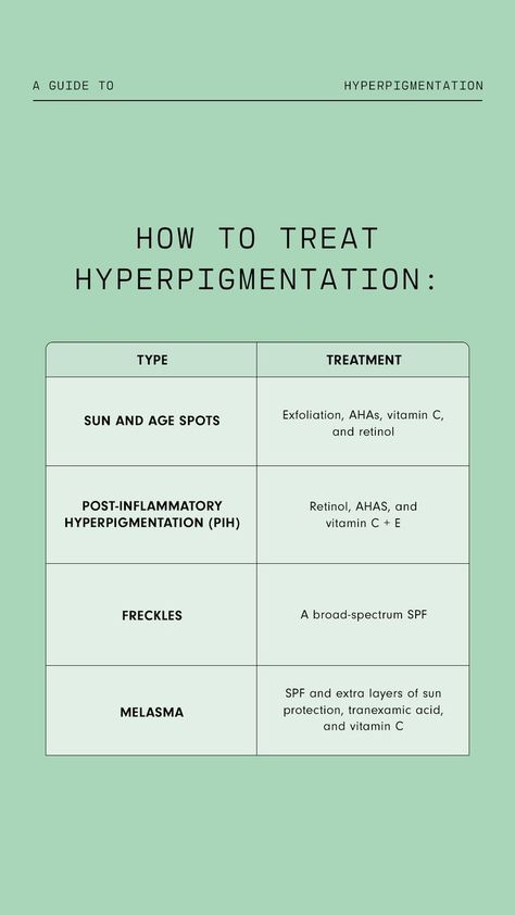 Treat Hyperpigmentation, Lotion For Oily Skin, Top Anti Aging Products, Skin Facts, Treating Hyperpigmentation, Tips For Oily Skin, Cream For Oily Skin, Skin Advice, Anti Wrinkle Skin Care