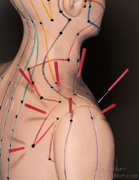 Punkty Spustowe, Acupuncture Points Chart, Sinus Pain, Acupressure Therapy, Point Acupuncture, Dry Needling, Acupuncture Points, Acupressure Points, Shoulder Pain