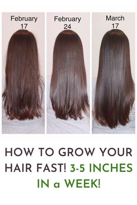 hair growth tips haircare haircare tips aesthetic hair hair tips hair growth oil grow hair faster      
hair growth tips how to grow your hair faster haircare hair growth hair tips hair mask hair care Long Hair Shampoo, Grow Your Hair Faster, Increase Hair Volume, Hair Fall Solution, Hair Growth Foods, How To Grow Your Hair Faster, Loss Hair, Hair Growing Tips, Growth Hair