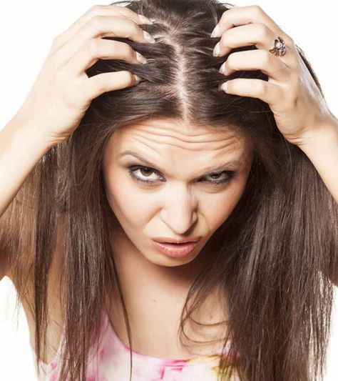 3507---Greasy-Scalp-and-Brittle-Ends---How-to-Treat Pimples On Scalp, Onion Juice For Hair, Home Remedies For Dandruff, Dunner Wordend Haar, Home Remedies For Hair, Grow Hair Faster, Hair And Beauty, Hair Regrowth, Hair Restoration