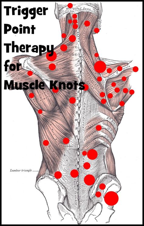 Painful muscles are debilitating but now you can have products to help at home. You don't need to see a specialist every time you have muscle knots. Punkty Spustowe, Muscle Knots, Massage Therapy Techniques, Trigger Point Therapy, Reflexology Massage, Trigger Point, Shiatsu Massage, Massage Benefits, Joints Pain Relief