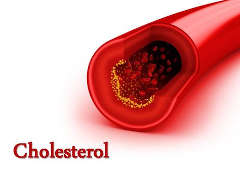 View and #Download Cholesterol, #PowerPoint #Presentation, give your #attractive #presentation with #ppt of Cholesterol. This #ppt presentation also use for other topics high cholesterol,chat is cholesterol,about cholesterol,#good and #bad cholesterol,#hdl cholesterol,#ldl cholesterol,cholesterol #counts,low cholesterol #diet. Foods To Reduce Cholesterol, Ways To Lower Cholesterol, Cholesterol Symptoms, Low Cholesterol Diet, Bad Cholesterol, High Cholesterol Levels, Cholesterol Lowering, Cholesterol Medications, Overnight Oat