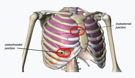 Rib Injury Clinic Xiphoid Process, Pectus Excavatum, Abdominal Crunch, Rib Tips, First Rib, Ligament Injury, Ribbed Flares, Ct Scan, A Skeleton