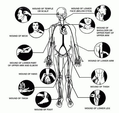 Pressure Point Fighting "Reality-Based Self-Defense You Can Trust" Contemporary Fighting Arts Pressure Points Self Defense, Human Pressure Points, Pressure Points Chart, Chinese Cupping, Damsel In Defense, Close Protection, Self Defence Training, Self Defense Women, Self Defense Tips