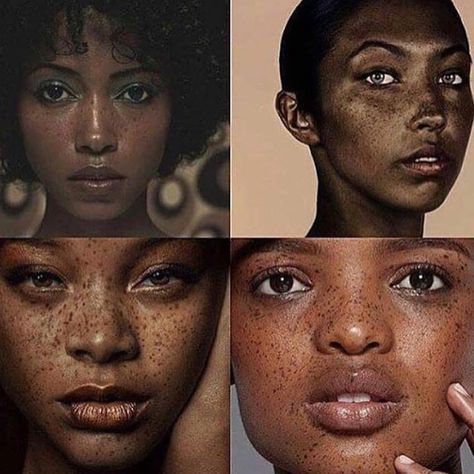 4,899 Likes, 361 Comments -  Taz's Angels (@tazsangels_) on Instagram: “Obsessed. ❤️ BBLU  Tag a baddie with freckles.   Embrace Flaws.” Freckles On Dark Skin, Black Freckles, People With Freckles, Remove Skin Tags Naturally, Women With Freckles, Beautiful Freckles, Faux Freckles, Freckles Girl, Freckle Face