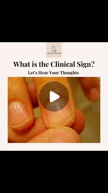 5 Minute Medicine on Instagram: "What is this clinical sign? 🤔 what is it associated with? Comment your thoughts and send to a medical friend! 
.
Visit our new site for med school essentials (www.5minmedicine.com)
.
.
.
.
Credit: https://m.youtube.com/watch?v=9m_0RAQDFHM
.
#medicine #medical #medstudent #doctor #medstudentlife #doctorlife #medstudents #medstudentnotes #doctorlifestyle #nurse #nurselife #nursepractitioner #medicalschool #medschoollife #medschoolproblems #medschoolmotivation #medschool #doctorlove  #medtest" Doctor Love, Med School Motivation, Medical School Essentials, Med Student, Med School, Nurse Practitioner, School Essentials, Nurse Life, Medical School