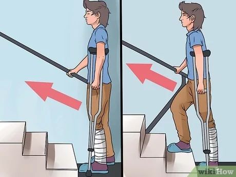 How to Walk on Crutches: Tips on Correct Hold, Gait, Stairs & Sitting How To Walk, Arm Muscles, Family Medicine, Crutches, Poses Reference, How To Go, Move Your Body, Physical Therapist, School Of Medicine