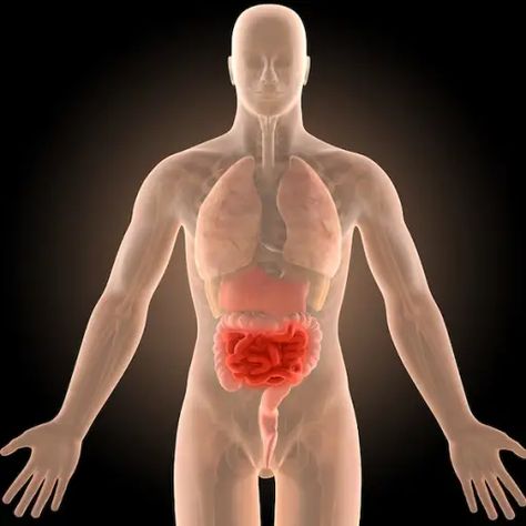 Chrons Disease Symptoms Crohns, Chrones Disease Symptoms, Chrons Disease Symptoms, Chrones Disease, Crohns Symptoms, Crohns Diet, Chrons Disease, Holistic Health Nutrition, Reflux Diet