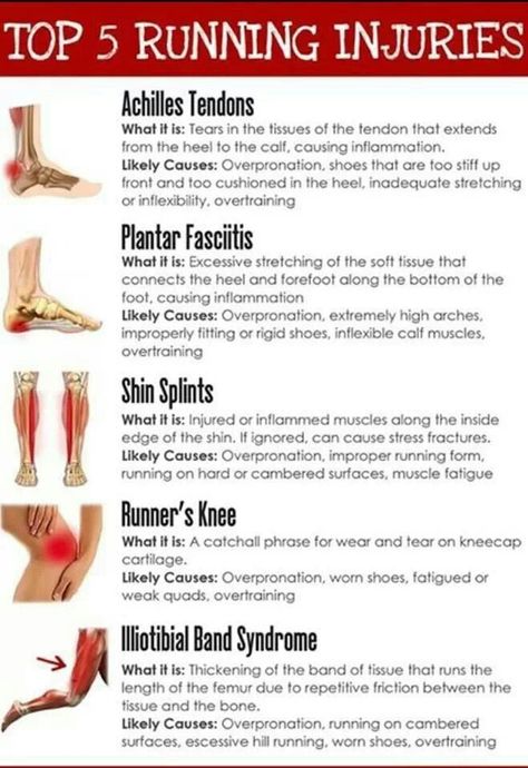 Top 5 running injuries--- Come see us for a consultation to help get rid of the pain! #PainSTOP #Injury Runners Knee, Runner Problems, Cross Training Workouts, Half Marathon Training Plan, Running Injuries, Sports Massage, Shin Splints, Nordic Walking, Running For Beginners