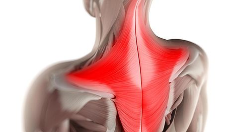 Strong Traps, Healthy Shoulders | T Nation Trapezius Muscle Pain, Shoulder Tension, Washable Pads, Muscle Protein, Muscle Strain, Tension Headache, Major Muscles, Heat Therapy, Muscle Tissue