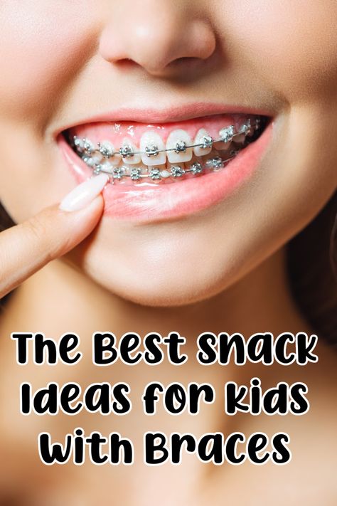 snacks for kids with braces Soft Foods After Getting Braces, Soft Foods After Braces Ideas, Easy Meals For Braces, School Lunch Ideas For Kids With Braces, Good Foods To Eat With Braces, Foods To Eat After Braces, Best Food To Eat With Braces, What To Eat After Braces, Soft Food Braces Ideas