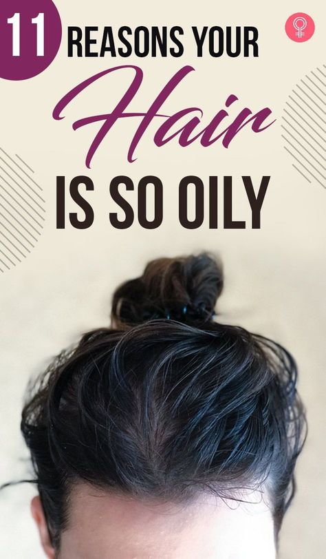 11 Reasons Your Hair Is So Oily: If you have an oily scalp, you’re not alone. We know that excess oil buildup can make your hair greasy, brittle, and grimy, which provides an excellent habitat for fungus to expand. In addition, it produces dandruff, a foul scalp, and makes your skin oily and acne-prone. To prevent this, you can tie your hair in a ponytail. How To Help Oily Hair, Oils For Oily Hair, Get Rid Of Greasy Hair, Prevent Oily Hair, Oily Hair Remedies, Using Dry Shampoo, Hair Care Recipes, Hair Growth Supplement, Oily Scalp