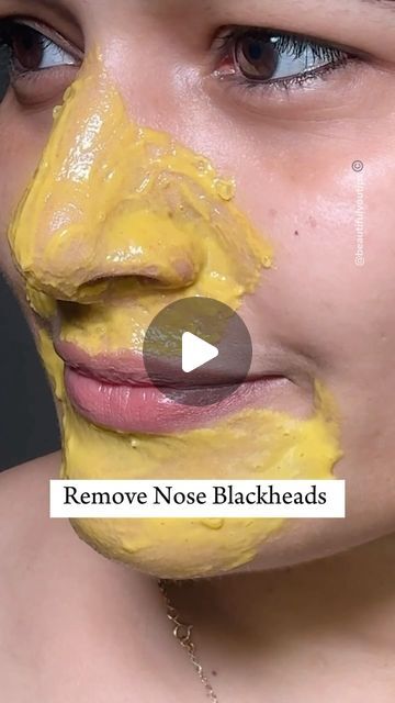 𝑩𝒆𝒂𝒖𝒕𝒊𝒇𝒖𝒍 𝒀𝒐𝒖 𝑻𝒊𝒑𝒔 on Instagram: "Nose & Chin blackhead, Whitehead removal, easy home-made remedy. Try this weekly, two time and you get best result get rid of blackhead Whitehead dead skin and get glass like shiny, healthy skin from your nose and chin areas, especially also you can ask me if you have any query or any doubt in the comment section Love to answer.❤️. . . . . . Follow for more. #skincare #beauty #beautytips #reels #blackheads" Home Remedy For Blackheads On Nose, Home Remedies For Blackheads, Nose Blackheads Removal At Home, How To Remove Blackheads At Home, How To Remove Blackheads From Nose, Blackheads Remedy, Home Remedy For Blackheads, Remove Blackheads From Nose Homemade, Blackheads Removal Homemade