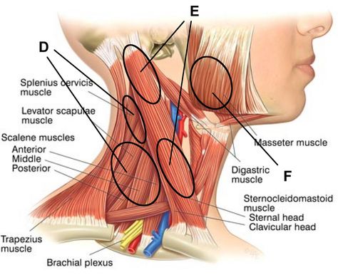 neck muscles pain and how to release it | Pain in the Neck Neck Muscle Anatomy, Punkty Spustowe, Anatomy Head, Sternocleidomastoid Muscle, Muscles Of The Neck, Muscle System, Massage Points, Muscle Anatomy, Neck And Shoulder Pain