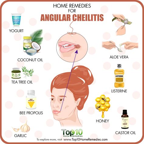 Lip Remedies, Cracked Corners Of Mouth, Lips Cracked, Chapped Lips Remedy, Angular Cheilitis, Character Customization, Top 10 Home Remedies, Hippie Living, Oil Remedies