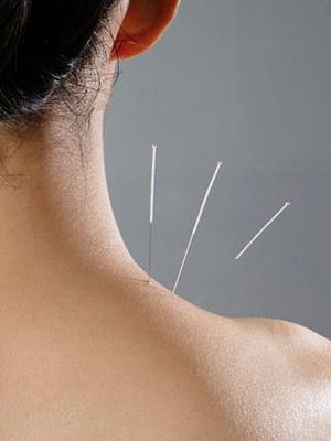 Natural treatments for fibromyalgia may help relieve your chronic pain. Learn about alternatives to prescription drugs, from vitamin D to acupuncture. Acupuncture Benefits, Joints Pain Remedy, Joints Pain Relief, Natural Treatments, Vitamin D, Acupuncture, Chronic Pain, Natural Remedies, Massage