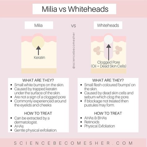 Science Becomes Her on Instagram: “𝐌𝐢𝐥𝐢𝐚 𝐯𝐬 𝐖𝐡𝐢𝐭𝐞𝐡𝐞𝐚𝐝𝐬  Milia are small white bumps on the skin that may be confused for acne. However, they are caused by a build up of…” Skin Knowledge, Back Acne, Skin Facts, Bad Acne, Skincare Acne, Skin Advice, Skin Aesthetics, Skin Science, Acne Remedies