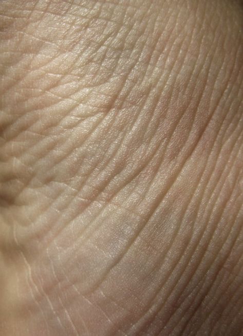 Free Texture Tuesday: Skin Flesh Texture, Wrinkles Photography, Human Skin Texture, Body Imperfections, Texture Skin, Human Photography, Skin Wrinkles, Skin Details, Texture Drawing