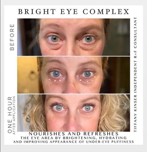 Bright Eye Complex Multifunction Eye Cream, Cream For Dark Circles, Under Eye Cream, Hydrating Eye Cream, Dark Eye Circles, Eye Cream For Dark Circles, Under Eye Puffiness, Upper Eyelid, Dark Circles Under Eyes