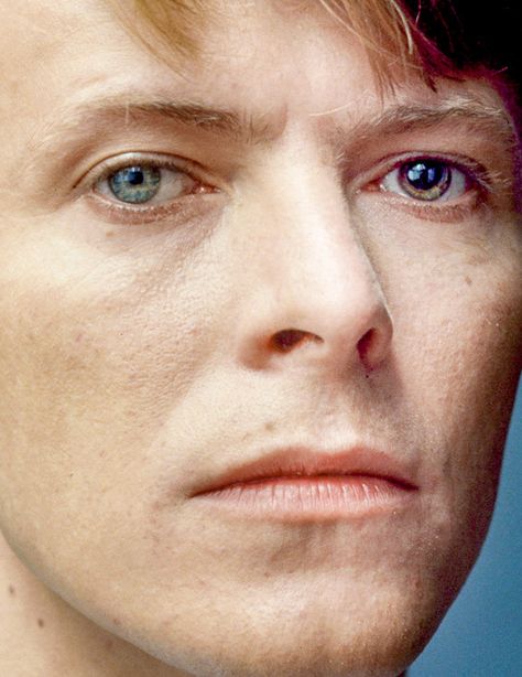 David Bowie Face, David Bowie Eyes, Bowie Eyes, David Bowie Music, David Bowie Fashion, Nose Jobs, Bad Skin, Bad Teeth, Fantastic Voyage