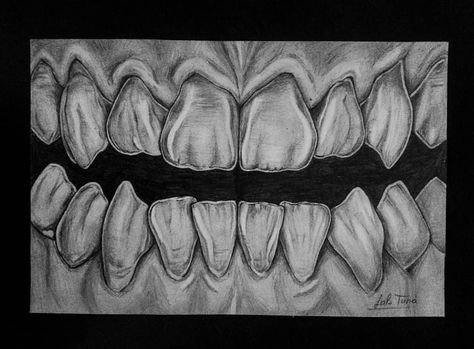 Teeth Sketch Anatomy, Denture Drawing, Dentistry Drawing, Dental Anatomy Drawing, Teeth Drawings, Dental Drawings, Teeth Sketch, Teeth Drawing Reference, Teeth Wallpaper