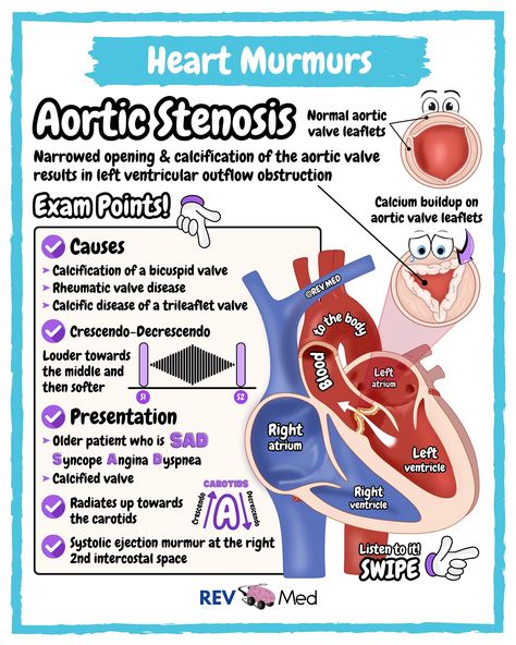 Which murmur would you like to see next? Comment it below ⤵️ Don’t forget to swipe this post and turn on the volume to listen 🩺 A whole lot of cardio is coming your way. Along with other topics only here �👉🏼 @rev.med Aortic Stenosis 🫀 High Yield ✅ Overview Type of heart valve disease (valvular heart disease). The valve between the lower left heart chamber and the body’s main artery (aorta) is narrowed and doesn’t open fully. This reduces or blocks blood flow from the heart to the aorta... Aortic Valve Stenosis Nursing, Nclex Hacks, Aortic Valve Stenosis, Heart Blood Flow, Cardiac Cath, Nursing Hacks, Medical Heart, Aortic Valve Replacement, Nursing Labs