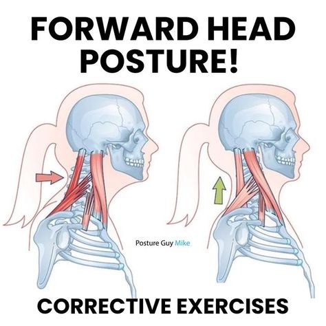 Michael Boshnack on Instagram: "⁉️ Want to improve your forward head posture?

🎯Try these three easy exercises! 

If you want a more comprehensive plan to follow,
check out my Posture App📲 Comment the words “GET STARTED” below and I’ll DM you an exclusive offer for 40% off my forward head posture program!

🤔 Not sure if you have forward head posture?
Comment the words “POSTURE TEST” below and I’ll DM you a FREE at home Posture test, so you can find out!

⬇️ Here is some background info on forward head posture!

🚶Forward head posture is a common condition where the head protrudes forward, out of alignment with the spine. 

😬 This misalignment often results from prolonged screen time, poor ergonomics, a lack of physical activity, and muscle imbalances. 

✅ By incorporating these exercis Forward Neck Posture Correction, Forward Head Posture Exercises, Physical Therapy Student, Neck And Shoulder Muscles, Forward Head Posture, Posture Exercises, Muscle Imbalance, Easy Exercises, Bad Posture