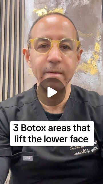 Lower Face Lift, Botox Injection Sites, Botox Brow Lift, Regular Skin Care Routine, Cheek Lift, Botox Before And After, Face Lift Surgery, Botox Face, Wrinkle Filler