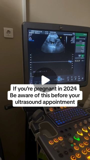 Snapframe | Live Ultrasound Frame on Instagram: "LlNK lN BlO to get your ultrasound frame!🥰👶" Ultrasound Gift Ideas, Ultrasound Frame, Frame Instagram, Neat Ideas, Ultrasound, Baby Stuff, Oven, Gift Ideas, Frame